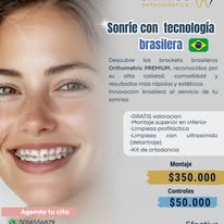 Santos Orthodontics - Aliados goaligner